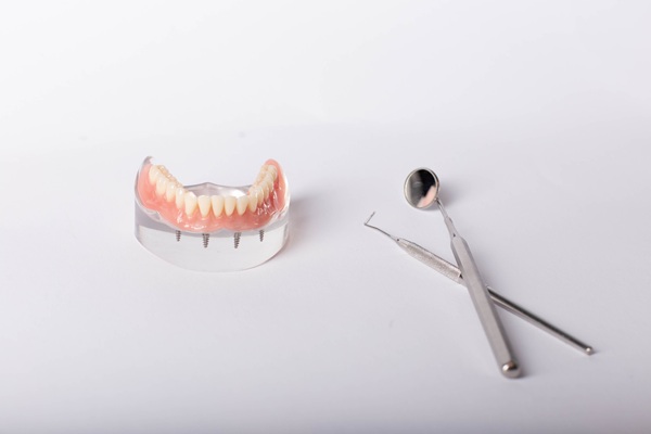 Ideal Candidates For All On   Implants