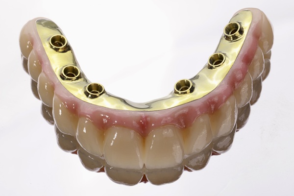 Implant Overdentures Vs  Traditional Dental Implants: What You Need To Know
