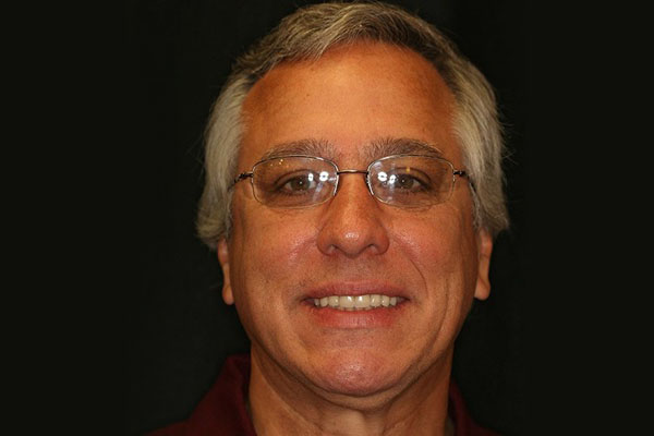 Smile Image 6