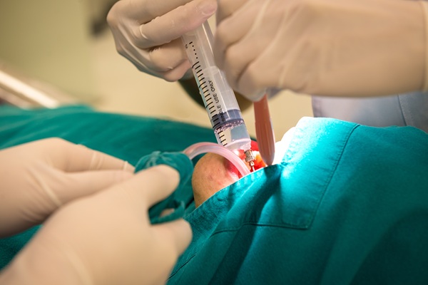 Common Oral Surgery Procedures