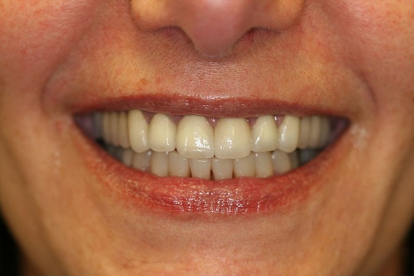 Smile Image 1