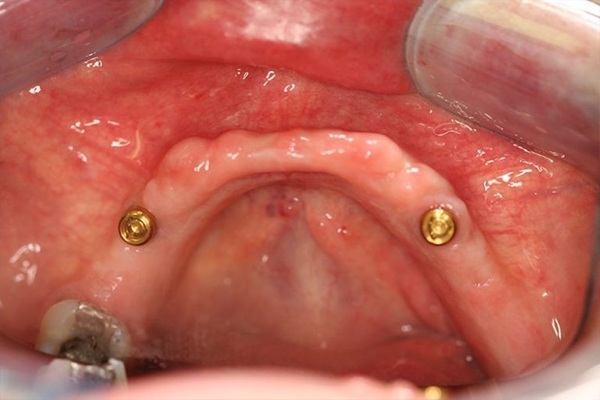 Smile Image 11