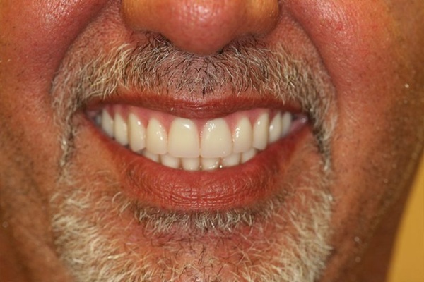 Smile Image 13