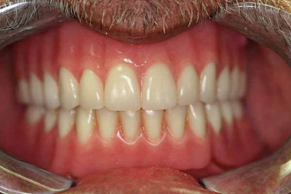 Smile Image 14