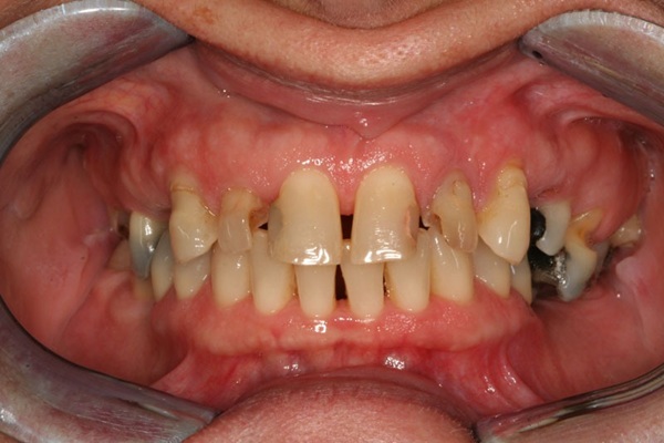 Smile Image 2