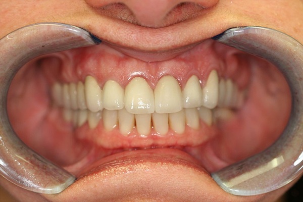 Smile Image 3