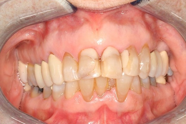 Smile Image 5