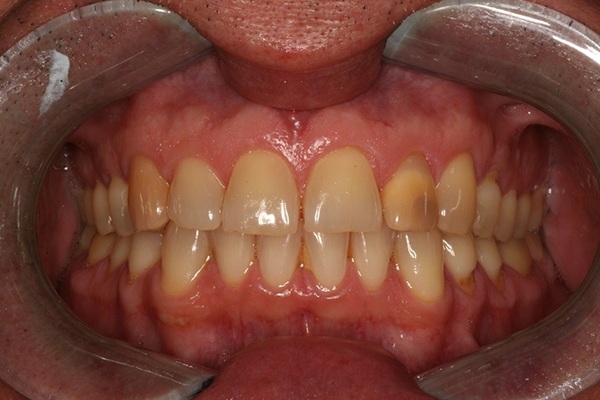 Smile Image 7