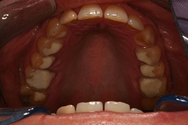 Smile Image 8