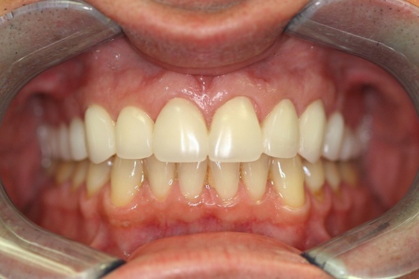 Smile Image 9
